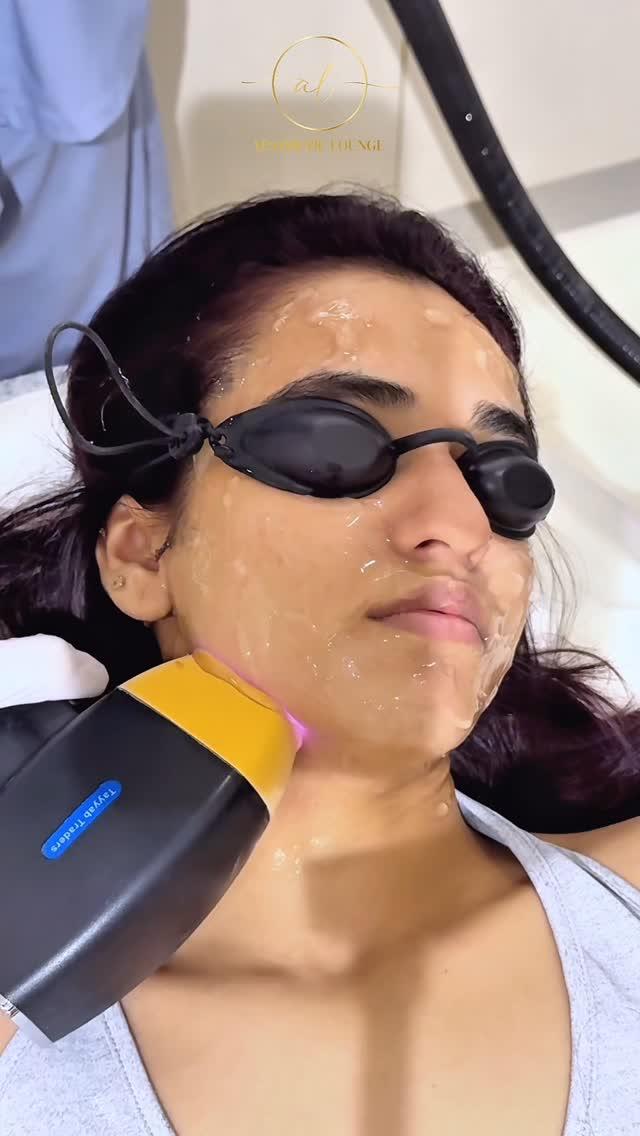Laser treatment session
