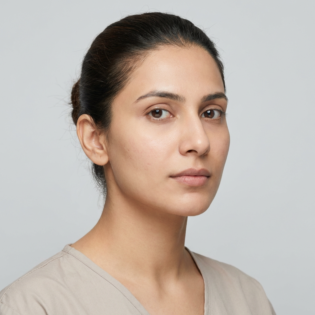 Acne Scarring — After